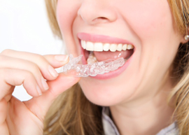 clear aligner brace